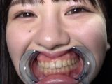 激レアな口内・歯・舌ベロ・のどちんこ観察 春日えな
