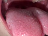 【個人撮影】安堂はるの 舌ブラシで「汚舌苔」採取